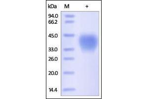 SDS-PAGE (SDS) image for CD48 (CD48) (AA 27-220) (Active) protein (His tag) (ABIN2180807)