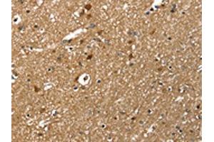 The image on the left is immunohistochemistry of paraffin-embedded Human brain tissue using ABIN7131518(TWF1 Antibody) at dilution 1/30, on the right is treated with fusion protein. (TWF1 抗体)