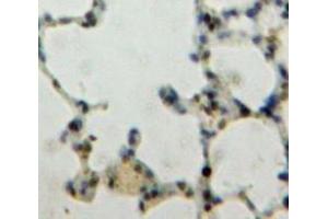 Used in DAB staining on fromalin fixed paraffin-embedded Lung tissue (KLF4 抗体  (AA 187-474))