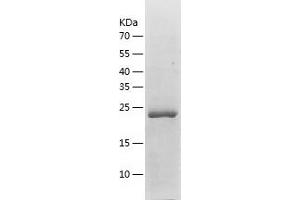 Western Blotting (WB) image for Insulin-Like Growth Factor Binding Protein 1 (IGFBPI) (AA 26-272) protein (His-IF2DI Tag) (ABIN7123459)