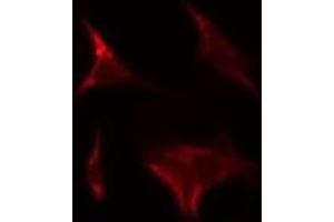 Immunofluorescence (fixed cells) (IF/ICC) image for anti-NADH Dehydrogenase (Ubiquinone) 1 alpha Subcomplex, 9, 39kDa (NDUFA9) (Internal Region) antibody (ABIN6259119)
