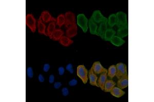 ABIN6262097 and ABIN6266556 staining Hela cells(24h of starvation treatment) by IF/ICC.