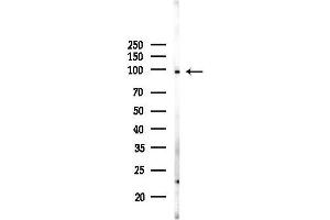 Western blot analysis of lysates from MCF7 cells(heat-shock,45 min treatment), using CUL4B Antibody at 1/1000 dilution.