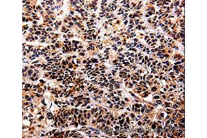 Immunohistochemistry of Human tonsil using IL10RA Polyclonal Antibody at dilution of 1:30 (IL-10RA 抗体)