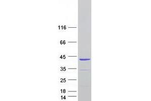 TNNT3 Protein (Transcript Variant 3) (Myc-DYKDDDDK Tag)