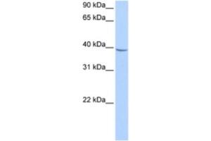 Western Blotting (WB) image for anti-Nudix (Nucleoside Diphosphate Linked Moiety X)-Type Motif 17 (NUDT17) antibody (ABIN2463190) (NUDT17 抗体)