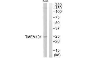 Western blot analysis of extracts from HuvEc cells, using TMEM101 antibody. (TMEM11 抗体)
