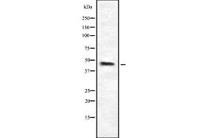 Western blot analysis of HPD using K562 whole cell lysates (HPD 抗体  (C-Term))