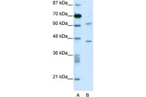 Western Blotting (WB) image for anti-TRM1 tRNA Methyltransferase 1-Like (TRMT1L) antibody (ABIN2460173) (TRMT1L 抗体)
