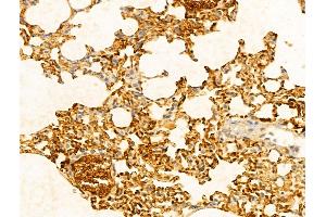 ABIN7094252 and ABIN7098299 at 1/100 staining Mouse lung tissue by IHC-P.