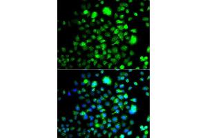 Immunofluorescence (IF) image for anti-Peroxisomal Biogenesis Factor 14 (PEX14) (AA 118-377) antibody (ABIN6145458)
