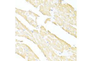 Immunohistochemistry of paraffin-embedded rat heart using UQCC2 antibody  at dilution of 1:100 (40x lens). (MNF1 抗体  (AA 14-126))