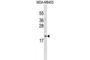 ADI1 Antibody (Center) western blot analysis in MDA-MB453 cell line lysates (35 µg/lane). (ADI1 抗体  (Middle Region))