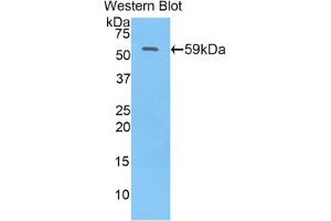 Western blot analysis of the recombinant protein. (N-Acetyl alpha-D-Glucosaminidase (AA 429-710) 抗体)