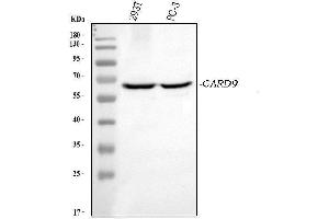 Western blot analysis of CARD9 using anti-CARD9 antibody (ABIN7599386). (CARD9 抗体  (AA 1-429))
