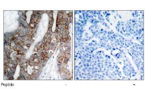 Image no. 1 for anti-Integrin beta 3 (ITGB3) (AA 771-775) antibody (ABIN197247) (Integrin beta 3 抗体  (AA 771-775))