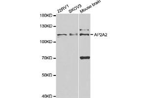 Western blot analysis of extracts of various cell lines, using AP2A2 antibody. (AP2A2 抗体)