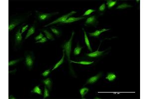 Immunofluorescence of purified MaxPab antibody to GEMIN7 on HeLa cell. (GEMIN7 抗体  (AA 1-131))