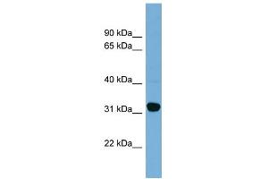 WB Suggested Anti-CBR1 Antibody Titration:  0. (CBR1 抗体  (Middle Region))