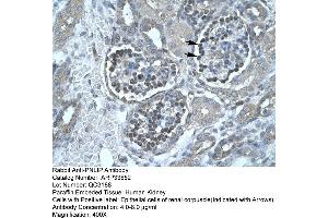 Human kidney (PNLIP 抗体  (C-Term))