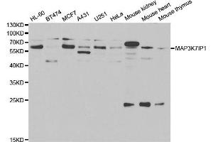 Western blot analysis of extracts of various cells, using TAB1 antibody. (TAB1 抗体)