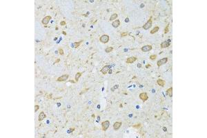 Immunohistochemistry (Paraffin-embedded Sections) (IHC (p)) image for anti-ATG7 Autophagy Related 7 (ATG7) (AA 500-676) antibody (ABIN3021091)