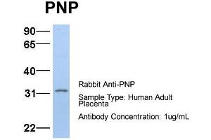 Host:  Rabbit  Target Name:  PNP  Sample Type:  Human Adult Placenta  Antibody Dilution:  1. (NP (Middle Region) 抗体)
