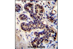 PROX2 Antibody (C-term) (ABIN656460 and ABIN2845744) immunohistochemistry analysis in formalin fixed and paraffin embedded human breast tissue followed by peroxidase conjugation of the secondary antibody and DAB staining. (PROX2 抗体  (C-Term))