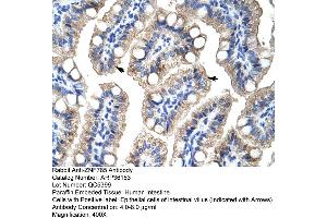 Human Intestine (ZNF785 抗体  (C-Term))