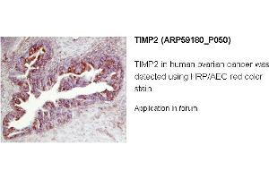 Image no. 1 for anti-Metalloproteinase Inhibitor 2 (TIMP2) (N-Term) antibody (ABIN2787967) (TIMP2 抗体  (N-Term))