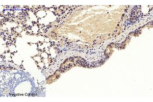 Immunohistochemical analysis of paraffin-embedded mouse lung tissue.