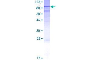 Image no. 1 for Outer Dense Fiber of Sperm Tails 2-Like (ODF2L) (AA 1-620) protein (GST tag) (ABIN1313336) (ODF2L Protein (AA 1-620) (GST tag))