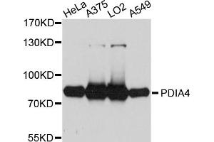 Western blot analysis of extracts of various cell lines, using PDIA4 antibody (ABIN5972424) at 1/1000 dilution. (PDIA4 抗体)