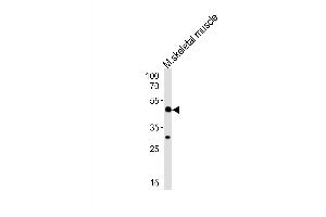 Western blot analysis of lysate from mouse skeletal muscle tissue lysate, using Mouse Hoxc10 Antibody at 1:1000 at each lane. (HOXC10 抗体  (C-Term))