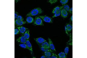 Immunofluorescence Analysis of HeLa cells labeling IGF-1 with IGF-1 Mouse Monoclonal Antibody (CTC05) labeled with CF647R (Green). (IGF1 抗体)