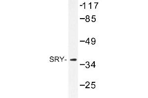Image no. 1 for anti-Sex Determining Region Y (SRY) antibody (ABIN272215) (SRY 抗体)