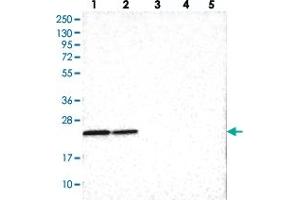 Western blot analysis of Lane 1: RT-4, Lane 2: U-251 MG, Lane 3: Human Plasma, Lane 4: Liver, Lane 5: Tonsil with SOX7 polyclonal antibody  at 1:100-1:250 dilution. (PINX1 抗体)