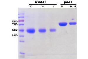 Image no. 1 for Alfa-1 Antitrypsin protein (ABIN1042573)
