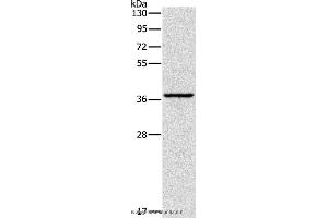 Western blot analysis of Huvec cell, using APOL2 Polyclonal Antibody at dilution of 1:375 (Apolipoprotein L 2 抗体)
