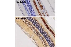 Immunohistochemistry (IHC) image for anti-Protein Disulfide Isomerase Family A, Member 3 (PDIA3) (C-Term) antibody (ABIN1440039)