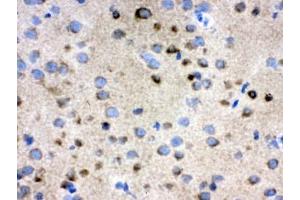 Immunohistochemistry (IHC) image for anti-Chaperonin Containing TCP1, Subunit 4 (Delta) (CCT4) antibody (ABIN4952801)