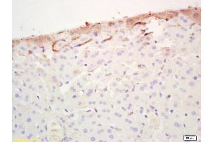 Formalin-fixed and paraffin embedded mouse liver labeled with Rabbit Anti FABP3/Cardiac FABP Polyclonal Antibody, Unconjugated (ABIN1387630) at 1:200 followed by conjugation to the secondary antibody and DAB staining