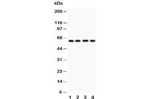 Western blot testing of HEXA antibody and Lane 1:  human placenta (Hexosaminidase A 抗体  (C-Term))