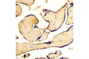 IHC analysis of FFPE human placenta tissue stained with EphA3 antibody (EPH Receptor A3 抗体  (AA 896-928))
