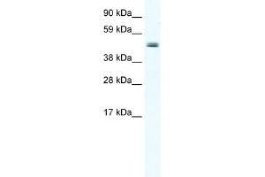 WB Suggested Anti-ELP4 Antibody Titration:  2. (ELP4 抗体  (Middle Region))