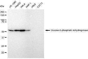 Western blotting analysis using Glucose-6-phosphate dehydrogenase antibody (ABIN7798733). (Recombinant Glucose-6-Phosphate Dehydrogenase 抗体)