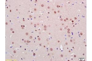 Formalin-fixed and paraffin embedded rat brain labeled with Rabbit Anti Phospho-HER3(Tyr1328) Polyclonal Antibody, Unconjugated (ABIN800628) at 1:200 followed by conjugation to the secondary antibody and DAB staining