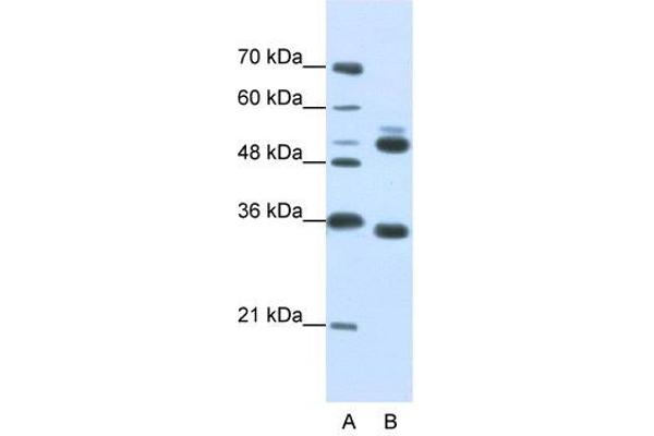 WDR6 抗体  (C-Term)