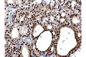 Immunohistochemistry (IHC) image for anti-Paired Box 8 (PAX8) antibody (ABIN2855097)