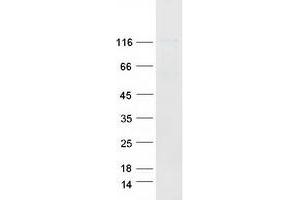 Western Blotting (WB) image for CD44 (CD44) (Transcript Variant 1) protein (Myc-DYKDDDDK Tag) (ABIN2713719)